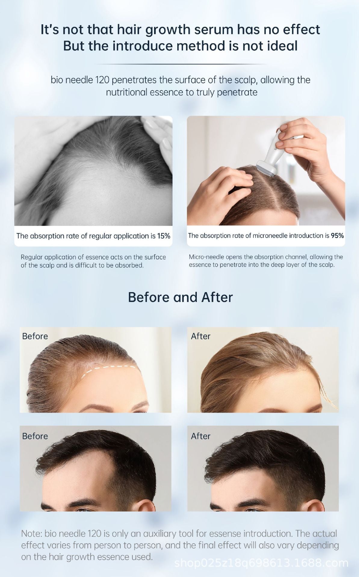 ✨Bioneedle: Your Ultimate Skin care companion✅