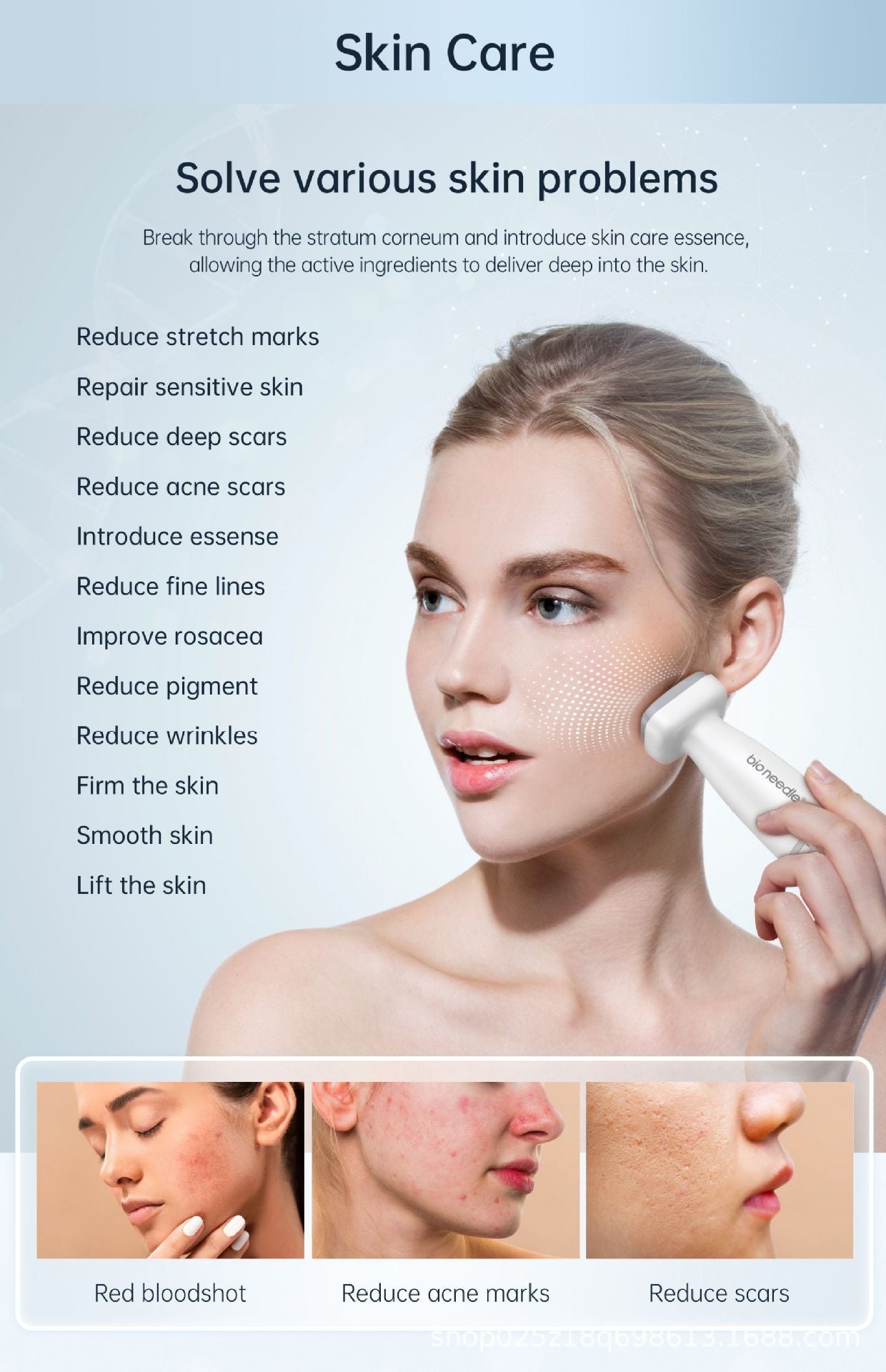 ✨Bioneedle: Your Ultimate Skin care companion✅